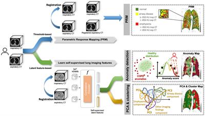 Capturing COPD heterogeneity: anomaly detection and parametric response mapping comparison for phenotyping on chest computed tomography